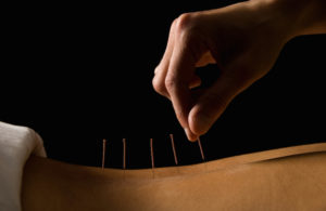 Chronische en onbegrepen klachten pak je aan met acupunctuur